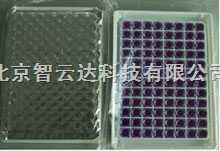 96?盒牛奶中抗生素快速检测试剂盒的图?/></a></div> <div class=