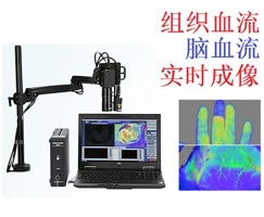 组织血流成像仪的图?/></a></div> <div class=