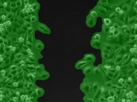 伤口愈合图像分析30002的图?/></a></div> <div class=