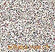 以色列CYSTRIP树脂 的图?/></a></div>              <div class=